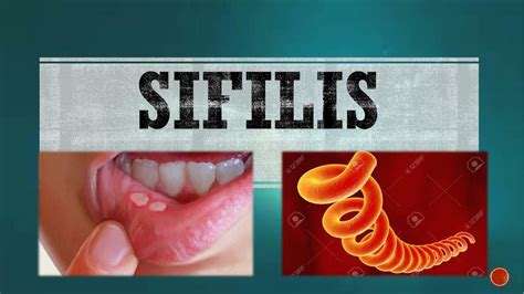 sifilis tiene cura
